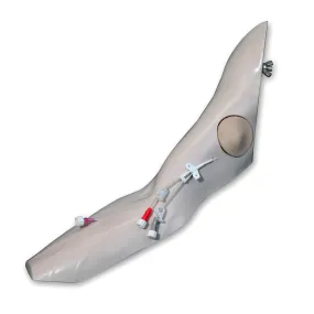 Port Access Arm for Chester Chest™, Lightly Pigmented